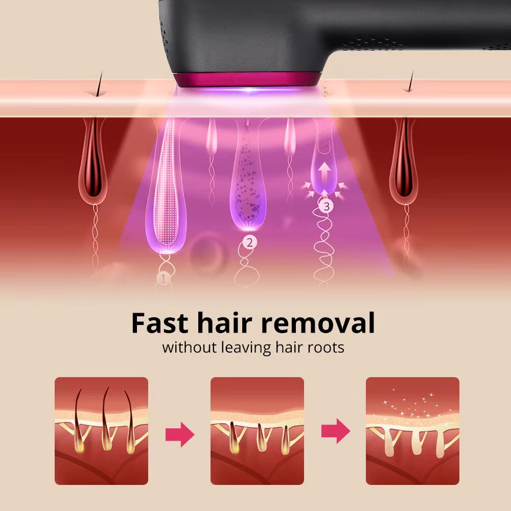 100,000 Flashes IPL Hair Removal Device for Home 5-Speed Pulse Light Painless Laser Hair Removal Device